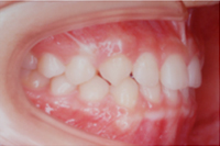 矯正歯科治療の対応症例
