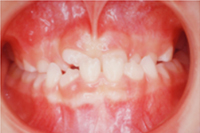 矯正歯科治療の対応症例
