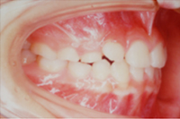 矯正歯科治療の対応症例
