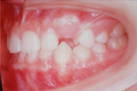 矯正歯科治療の対応症例