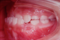 矯正歯科治療の対応症例