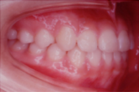 矯正歯科治療の対応症例