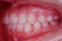 矯正歯科治療の対応症例
