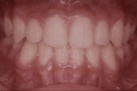 矯正歯科治療の対応症例
