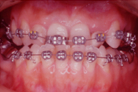 矯正歯科治療の対応症例