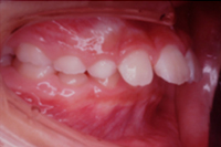 矯正歯科治療の対応症例