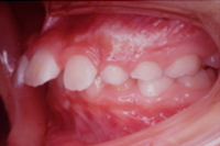 矯正歯科治療の対応症例