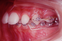 矯正歯科治療の対応症例