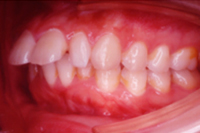矯正歯科治療の対応症例