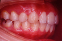 矯正歯科治療の対応症例