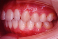 矯正歯科治療の対応症例