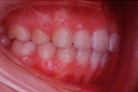 矯正歯科治療の対応症例