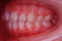 矯正歯科治療の対応症例