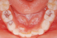 矯正歯科治療の対応症例