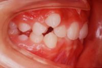 矯正歯科治療の対応症例