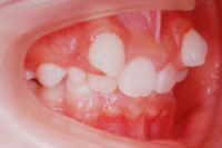 矯正歯科治療の対応症例