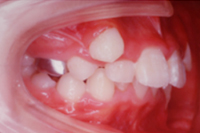 矯正歯科治療の対応症例
