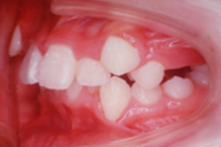 矯正歯科治療の対応症例