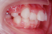 矯正歯科治療の対応症例