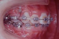矯正歯科治療の対応症例