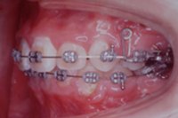 矯正歯科治療の対応症例