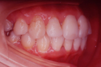 矯正歯科治療の対応症例