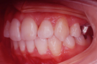 矯正歯科治療の対応症例