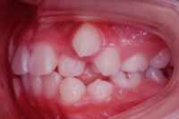 矯正歯科治療の対応症例