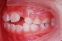 矯正歯科治療の対応症例