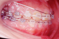 矯正歯科治療の対応症例