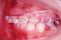 矯正歯科治療の対応症例