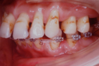 矯正歯科治療の対応症例