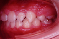 矯正歯科治療の対応症例