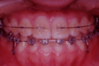 矯正歯科治療の対応症例